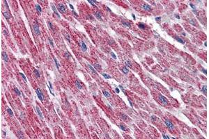 Human Heart: Formalin-Fixed, Paraffin-Embedded (FFPE) (DLD antibody  (AA 1-510))