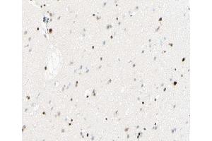 ABIN6267431 at 1/100 staining human brain tissue sections by IHC-P. (NFKB1 antibody  (pSer893))