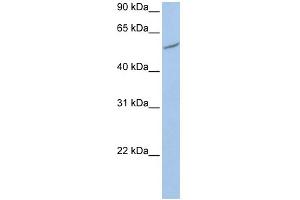 WB Suggested Anti-RIOK3 Antibody Titration:  0. (RIOK3 antibody  (C-Term))