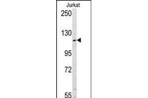 Western blot analysis of anti-USP11 Pab (ABIN388894 and ABIN2839183) in Jurkat cell line lysates (35 μg/lane). (USP11 antibody  (N-Term))