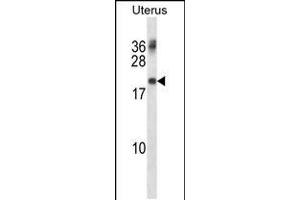 Western blot analysis in human normal Uterus tissue lysates (35ug/lane). (PMP22 antibody  (AA 102-130))