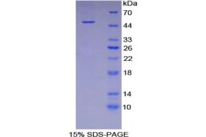 SDS-PAGE analysis of Human Fetuin B Protein. (FETUB Protein)