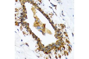Immunohistochemistry of paraffin-embedded human breast using RAIDD/CRADD Rabbit mAb (ABIN7266107) at dilution of 1:100 (40x lens).