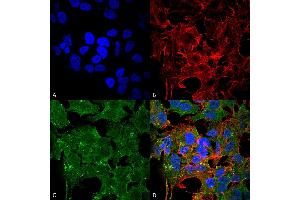 Immunocytochemistry/Immunofluorescence analysis using Mouse Anti-GluN2A/NR2A Monoclonal Antibody, Clone S327A-38 . (NMDAR2A antibody  (AA 75-325) (Atto 594))