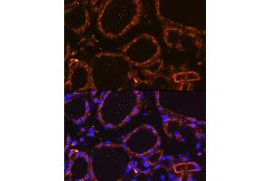 Immunofluorescence analysis of Mouse thyroid using WNT5A Rabbit pAb (ABIN6134458, ABIN6150248, ABIN6150249 and ABIN6216485) at dilution of 1:100. (WNT5A antibody  (AA 250-350))