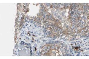 ABIN6274616 at 1/100 staining Human prostate tissue by IHC-P. (CDCA3 antibody  (C-Term))