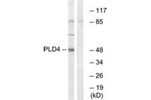 Western blot analysis of extracts from Jurkat cells, using PLD4 Antibody.