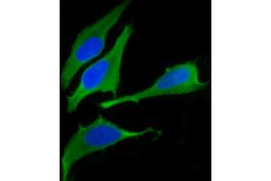 Immunofluorescence (IF) image for anti-Fatty Acid Synthase (FASN) (AA 942-973) antibody (ABIN1537694)