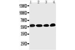 Anti-Egr1 antibody, Western blotting Lane 1: Rat Brain Tissue Lysate Lane 2: HELA Cell Lysate Lane 3: MCF-7 Cell Lysate Lane 4: COLO320 Cell Lysate (EGR1 antibody  (N-Term))