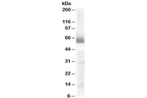 Western blot testing of human ovay lysate with CYP17A1 antibody at 0. (CYP17A1 antibody)