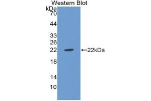 Detection of Recombinant vWF, Rat using Polyclonal Antibody to Von Willebrand Factor (vWF) (VWF antibody  (AA 49-230))