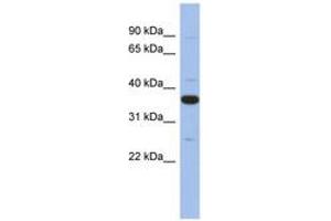 Image no. 1 for anti-Myeloid Differentiation Primary Response Gene (88) (MYD88) (AA 215-264) antibody (ABIN6744059)