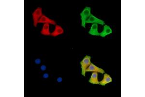 ABIN7095824 and ABIN7099886 staining Hela cells by IF/ICC. (SYDE1 antibody)