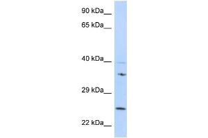 GRB2 Antibody - N-terminal region (ARP58474_P050) validated by WB using 721_B cell Lysate at 1 µg/mL. (GRB2 antibody  (N-Term))