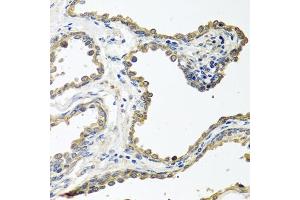 Immunohistochemistry of paraffin-embedded human prostate using COLEC11 antibody (ABIN6130117, ABIN6138854, ABIN6138855 and ABIN6220812) at dilution of 1:100 (40x lens). (COLEC11 antibody  (AA 26-271))