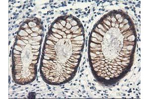Immunohistochemical staining of paraffin-embedded Human colon tissue using anti-NAPEPLD mouse monoclonal antibody. (NAPEPLD antibody)