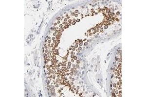 Immunohistochemical staining of human testis with IFT43 polyclonal antibody  shows strong cytoplasmic positivity in cells in seminiferus ducts at 1:50-1:200 dilution.