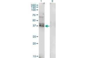 Western Blot analysis of LAIR1 expression in transfected 293T cell line by LAIR1 monoclonal antibody (M01), clone 2G4.