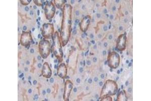 Used in DAB staining on fromalin fixed paraffin- embedded Kidney tissue (CD164 antibody  (AA 24-162))