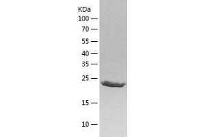 Western Blotting (WB) image for Leucine Rich Repeat Containing 59 (LRRC59) (AA 1-244) protein (His tag) (ABIN7123750) (LRRC59 Protein (AA 1-244) (His tag))