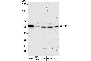 Western Blotting (WB) image for anti-Tripeptidyl Peptidase I (TPP1) (AA 150-200) antibody (ABIN7452108)