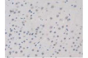 IHC-P analysis of Mouse Brain Tissue, with DAB staining. (BRD8 antibody  (AA 797-951))