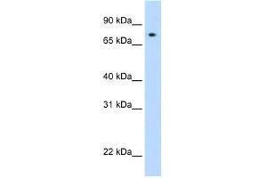 WB Suggested Anti-STAT1 Antibody Titration: 0. (STAT1 antibody  (N-Term))