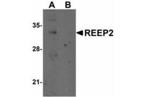 Image no. 1 for anti-Receptor Accessory Protein 2 (REEP2) (Internal Region) antibody (ABIN478103) (REEP2 antibody  (Internal Region))