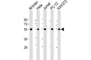 All lanes : Anti-beta II Tubulin at 1:8000 dilution Lane 1: mouse brain lysate Lane 2: Hela whole cell lysate Lane 3: Jurkat whole cell lysate Lane 4: PC-12 whole cell lysate Lane 5: NIH/3T3 whole cell lysate Lysates/proteins at 20 μg per lane. (TUBB2A antibody  (AA 14-46))