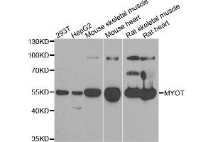Western blot analysis of extracts of various cell lines, using MYOT antibody (ABIN5973839) at 1/1000 dilution. (Myotilin antibody)