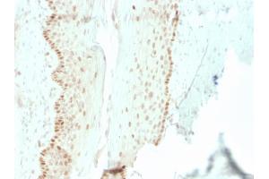 Formalin-fixed, paraffin-embedded human cervix stained with SOX2 Recombinant Mouse Monoclonal Antibody (rSOX2/1792). (Recombinant SOX2 antibody  (AA 176-305))