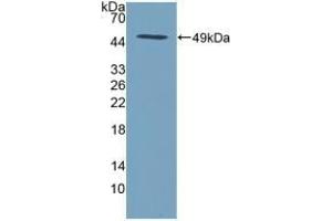 Detection of Recombinant SPINT2, Human using Polyclonal Antibody to Serine Peptidase Inhibitor Kunitz Type 2 (SPINT2) (SPINT2 antibody  (AA 28-197))