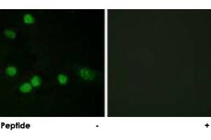 Immunofluorescence analysis of HeLa cells, using RAF1 polyclonal antibody .
