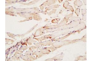 Formalin-fixed and paraffin embedded rat muscle labeled with Rabbit Anti-CNTF Receptor alpha Polyclonal Antibody at 1:200 followed by conjugation to the secondary antibody and DAB staining (CNTF Receptor alpha antibody  (AA 151-160))