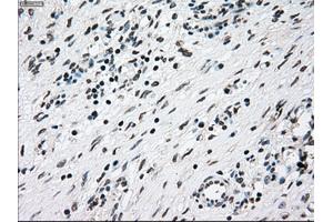 Immunohistochemical staining of paraffin-embedded lung tissue using anti-NRBP1mouse monoclonal antibody. (NRBP1 antibody)