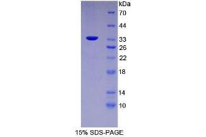 SDS-PAGE analysis of Mouse FUCa1 Protein. (FUCA1 Protein)