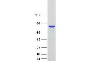 Validation with Western Blot (SNX17 Protein (Myc-DYKDDDDK Tag))