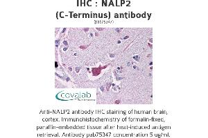 Image no. 1 for anti-NLR Family, Pyrin Domain Containing 2 (NLRP2) antibody (ABIN1737196) (NLRP2 antibody)