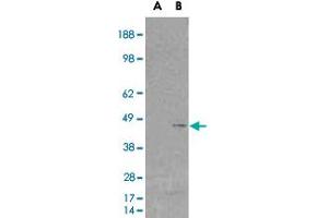 HEK293 overexpressing SKAP2 (RC206119) and probed with EB05356 (mock transfection in first lane), tested by Origene. (SKAP2 antibody)