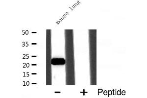 Western blot analysis of CSRP1 expression in Mouse lung lysate (CSRP1 antibody  (Internal Region))