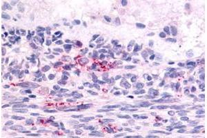 Immunohistochemical staining of human ovary, graafian follicle with LPHN2 polyclonal antibody . (LPHN2 antibody  (N-Term))