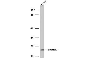 HUVEC lysates probed with Bik/NBK Polyclonal Antibody, Unconjugated  at 1:300 dilution and 4˚C overnight incubation. (BIK antibody  (AA 10-90))