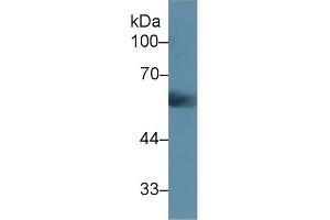 Detection of UMOD in Mouse Serum using Polyclonal Antibody to Uromodulin (UMOD) (Uromodulin antibody  (AA 32-151))