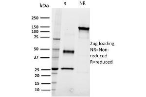 SDS-PAGE Analysis Purified CD22 Mouse Monoclonal Antibody (RFB4). (CD22 antibody)