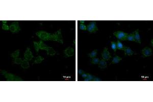 ICC/IF Image Glycerol kinase antibody [N3C2], Internal detects Glycerol kinase protein at mitochondria by immunofluorescent analysis. (Glycerol Kinase antibody)