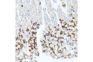 Immunohistochemistry of paraffin-embedded mouse stomach using GPM6A antibody. (GPM6A antibody)