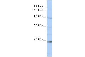 WB Suggested Anti-NCKAP1L Antibody Titration:  0. (NCKAP1L antibody  (N-Term))