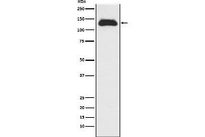 Western blot analysis of Eg5 expression in Raji cell lysate. (Recombinant KIF11 antibody)