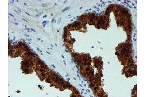 Image no. 3 for anti-Phosphoglucomutase 3 (PGM3) antibody (ABIN1500178)