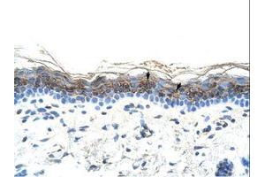 Image no. 1 for anti-ZIC2 (ZIC2) (AA 446-495) antibody (ABIN6736299) (ZIC2 antibody  (AA 446-495))